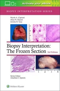 Biopsy Interpretation. The Frozen Section