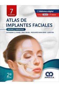 Atlas de Implantes Faciales