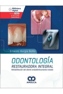 Odontología Restauradora Integral "Rehabilitación del Diente Endodónticamente Tratado"