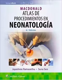 Macdonald Atlas de Procedimientos en Neonatología