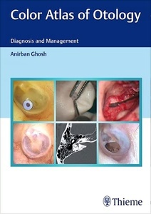 Color Atlas of Otology "Diagnosis and Management"