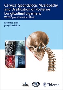 Cervical Spondylotic Myelopathy and Ossification of Posterior Longitudinal Ligament "WFNS Spine Committee Book"
