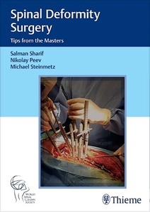 Spinal Deformity Surgery "Tips from the Masters"