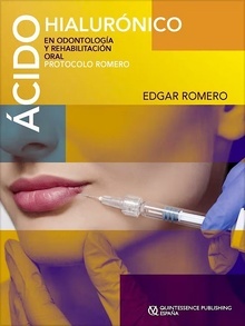 Ácido Hialurónico en Odontología y Rehabilitación Oral "Protocolo Romero"