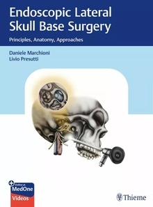 Endoscopic Lateral Skull Base Surgery "Principles, Anatomy, Approaches"