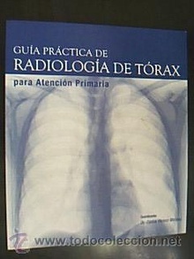 Guía Práctica de Radiología de Torax para Atención Primaria