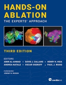 Hands-On Ablation "The Experts' Approach"