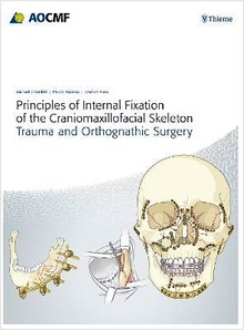 Principles of Internal Fixation of the Craniomaxillofacial Skeleton "Trauma and Orthognathic Surgery"