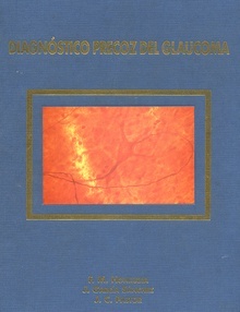 Diagnóstico Precoz del Glaucoma