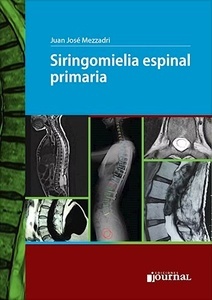 Siringomielia Espinal Primaria