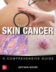 Skin Cancer "A Comprehensive Guide"
