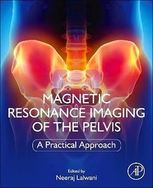 Magnetic Resonance Imaging of The Pelvis "A Practical Approach"