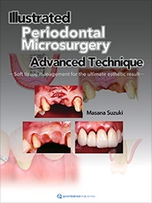 Illustrated Periodontal Microsurgery "Advanced Technique Soft Tissue Management for the Ultimate Esthetic Result"