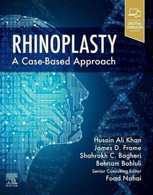 Rhinoplasty "A Case-Based Approach"