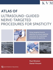 Atlas Of Ultrasound Guided Nerve Targeted Procedures For Spasticity