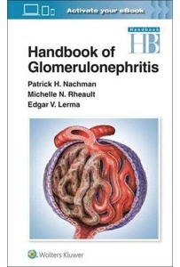 Handbook Of Glomerulonephritis