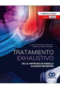 Tratamiento Exhaustivo de la Artrosis de Rodilla "Avances Recientes"