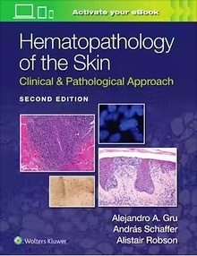 Hematopathology of the Skin "Clinical and Pathological Approach"
