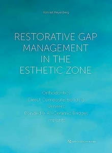 Restorative Gap Management in the Esthetic Zone "Orthodontics. Direct Composite Bonding. Veneers. Bonded & All-Ceramic Bridges. Implants"