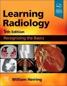Learning Radiology "Recognizing The Basics"