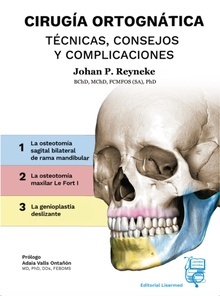 Cirugía Ortognática "Técnicas  Consejos y Complicaciones"