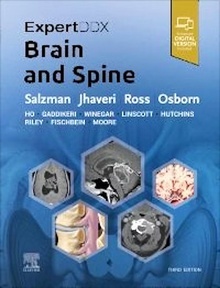 ExpertDDX Brain and Spine