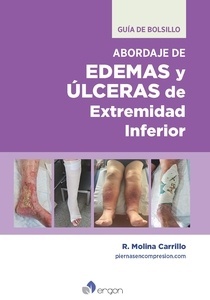 Guía de Bolsillo Abordaje de Edemas y Úlceras de Extremidad Inferior