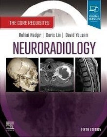 Neuroradiology "The Core Requisites"