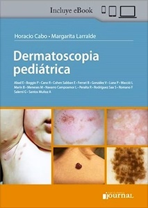 Dermatoscopia Pediátrica