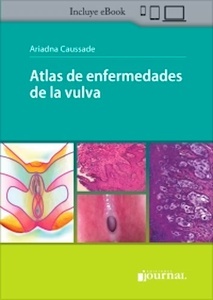 Atlas de Enfermedades de la Vulva