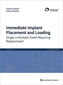 Immediate Implant Placement and Loading "Single or Multiple Teeth Requiring Replacement"