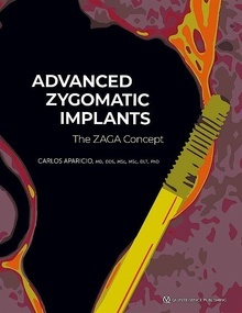 Advanced Zygomatic Implants "The Zaga Concept"