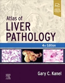 Atlas Of Liver Pathology
