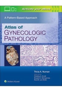 Atlas Of Gynecologic Pathology "A Pattern-Based Approach"