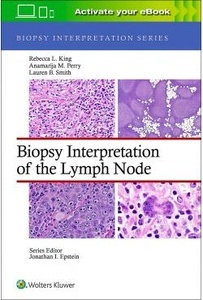 Biopsy Interpretation Of The Lymph Nodes