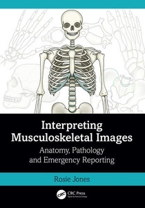 Interpreting Musculoskeletal Images "Anatomy, Pathology and Emergency Reporting"