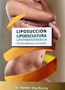 Liposucción, Lipoescultura, Lipotransferencia "Técnicas Básicas y Avanzadas"