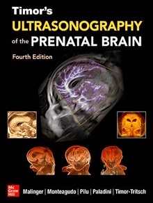 TIMOR's Ultrasonography of the Prenatal Brain