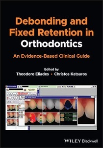 Debonding and Fixed Retention in Orthodontics "An Evidence-Based Clinical Guide"