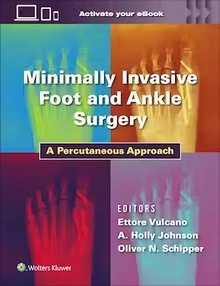 Minimally Invasive Foot and Ankle Surgery "A Percutaneous Approach"