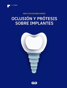 Oclusión y Prótesis sobre Implantes