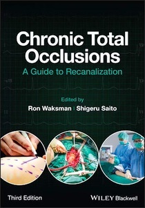 Chronic Total Occlusions. "A Guide to Recanalization"
