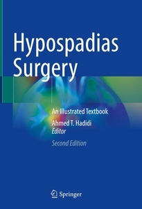 Hypospadias Surgery "An Illustrated Textbook"