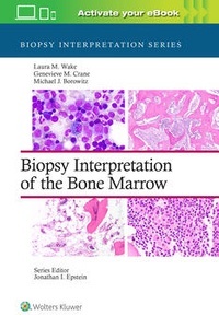 Biopsy Intrepretation Of The Bone Marrow