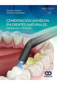 Cementación Adhesiva en Dientes Naturales "Materiales y Técnicas"