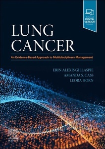 Lung Cancer "An Evidence-Based Approach to Multidisciplinary Management"