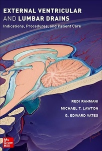 External Ventricular and Lumbar Drains "Indications, Procedures, and Patient Care"
