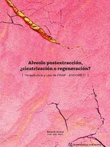 Alveolo Postextracción "¿Cicatrización o Regeneración?"