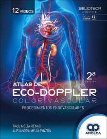 Atlas de Eco-Doppler Color Vascular "Procedimientos Endovasculares"
