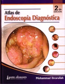 Atlas de Endoscopía Diagnóstica